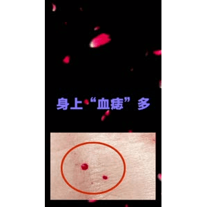 健康养生1044
