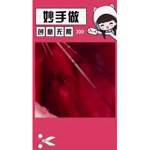 生活小妙招4456